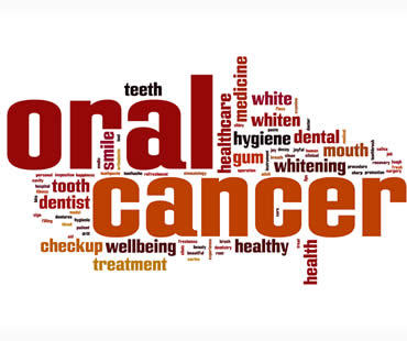 Private: Oral Cancer Explained